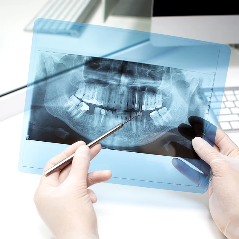X-ray ช่องปาก