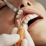 นอนกัดฟัน (Bruxism) อันตรายต่อฟันและวิธีป้องกันด้วยเฝือกสบฟัน
