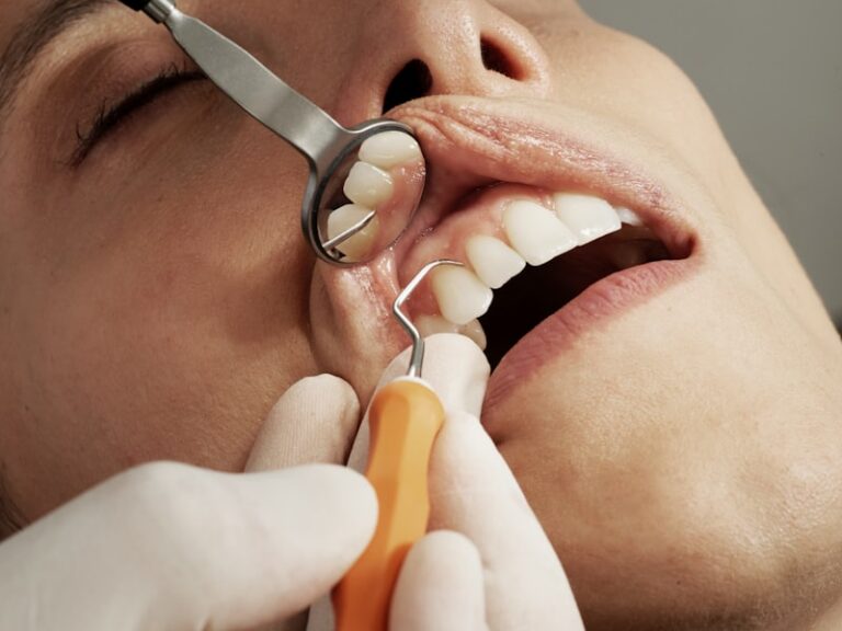 นอนกัดฟัน (Bruxism) อันตรายต่อฟันและวิธีป้องกันด้วยเฝือกสบฟัน